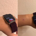 Apple Watch Skin Irritation: Series 12 Sensor Issues