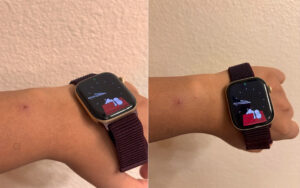 Apple Watch Skin Irritation: Series 12 Sensor Issues