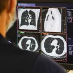 AI Cancer Survival Predictor: Facial Photos Gauge Lifespan