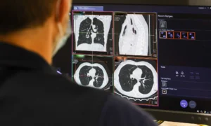 AI Cancer Survival Predictor: Facial Photos Gauge Lifespan