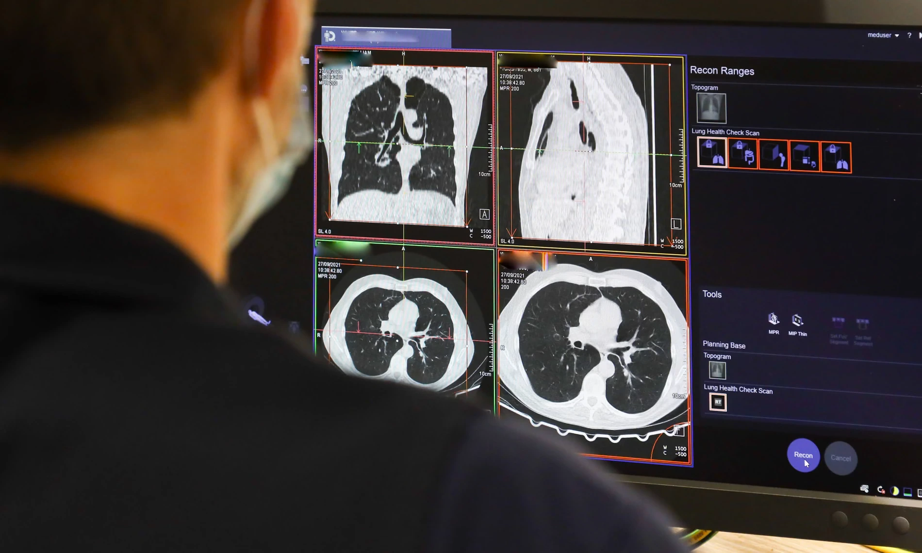 AI cancer survival predictor analyzing facial photographs for oncology patients